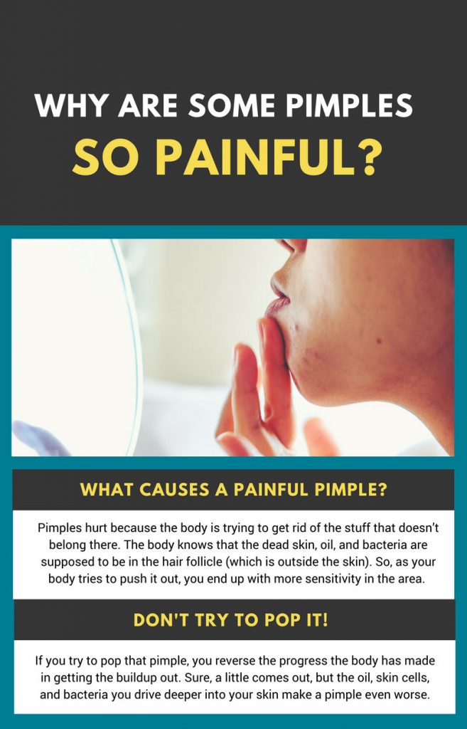 painful-pimple-causes-epiphany-dermatology