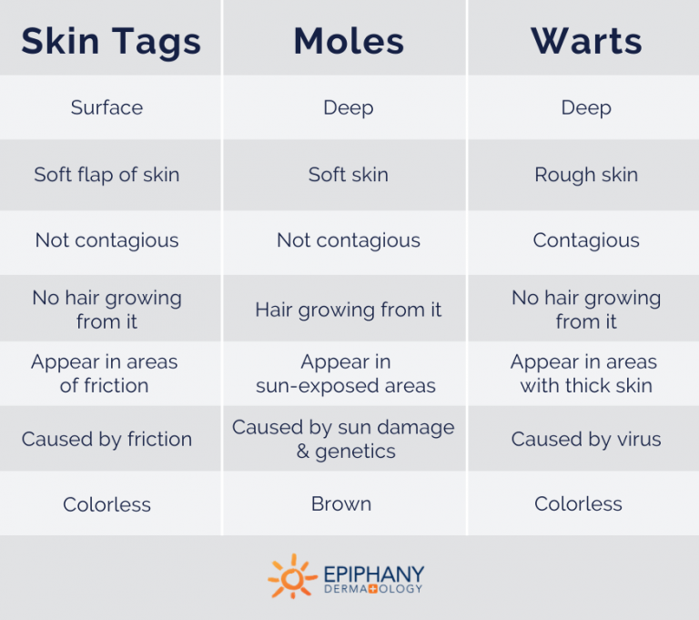 How to Tell the Difference Between Skin Tags, Moles, & Warts