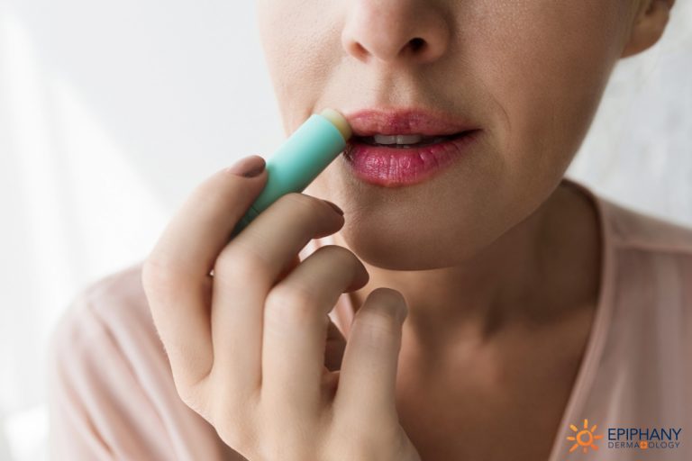 The Truth About Your Lip Balm Addiction Epiphany Dermatology