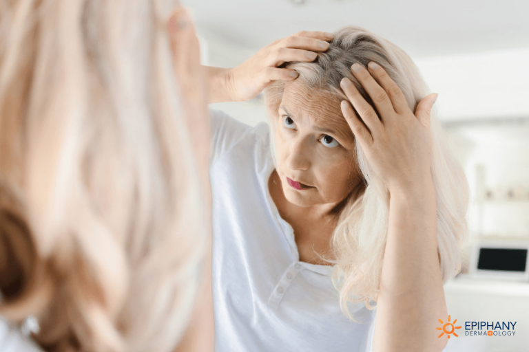 What Is Frontal Fibrosing Alopecia Things You Should Know About This