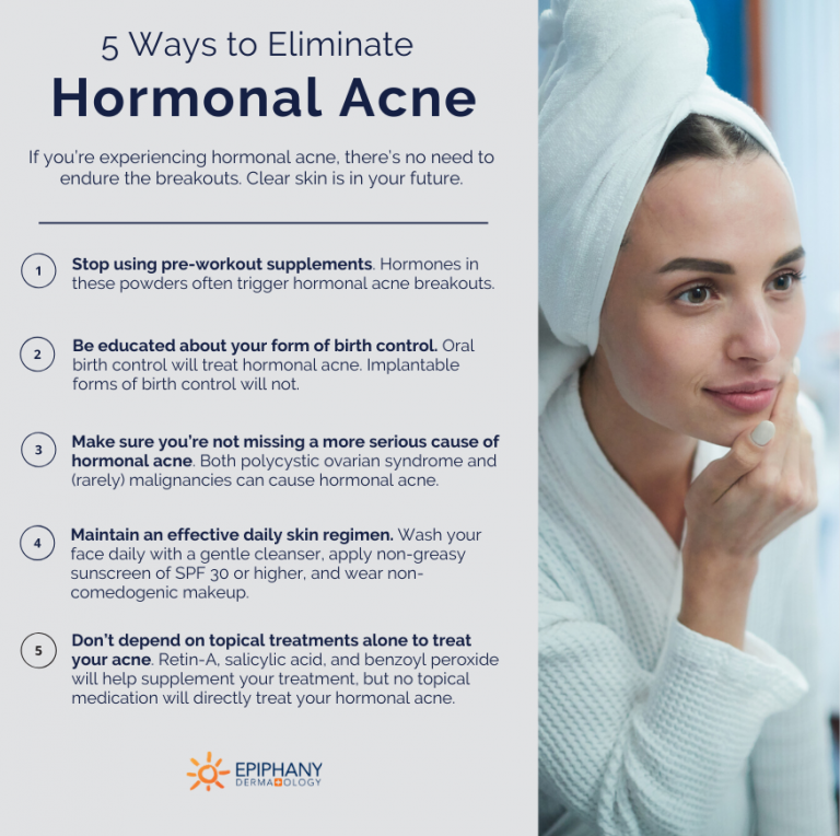 How To Get Rid Of Hormonal Acne Diagnosis Treatment Options