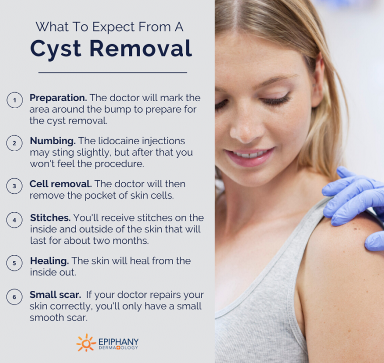 Dermatologist in Palm Beach That Removes Cysts With Blue Cross Blue