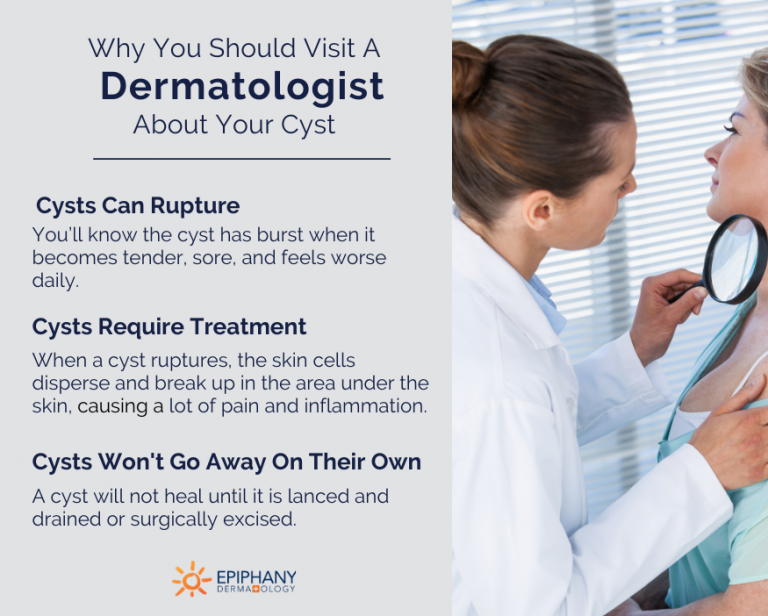 Skin Cysts: When Is It Time to See A Dermatologist?