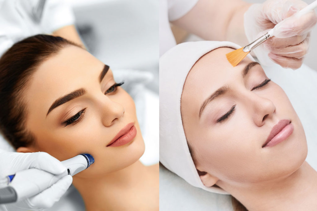 microdermabrasion and chemical peel